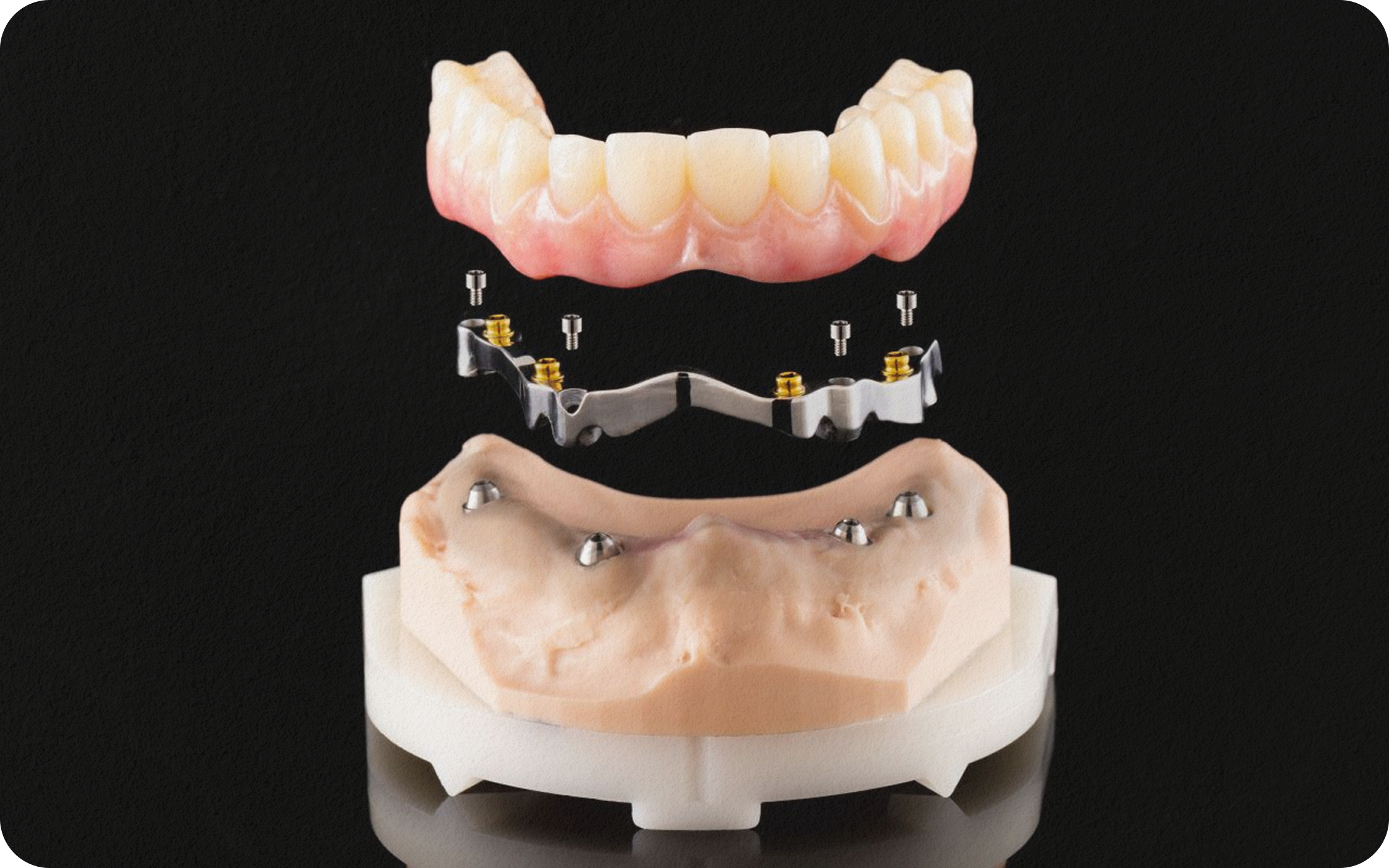 Luxur Titanium