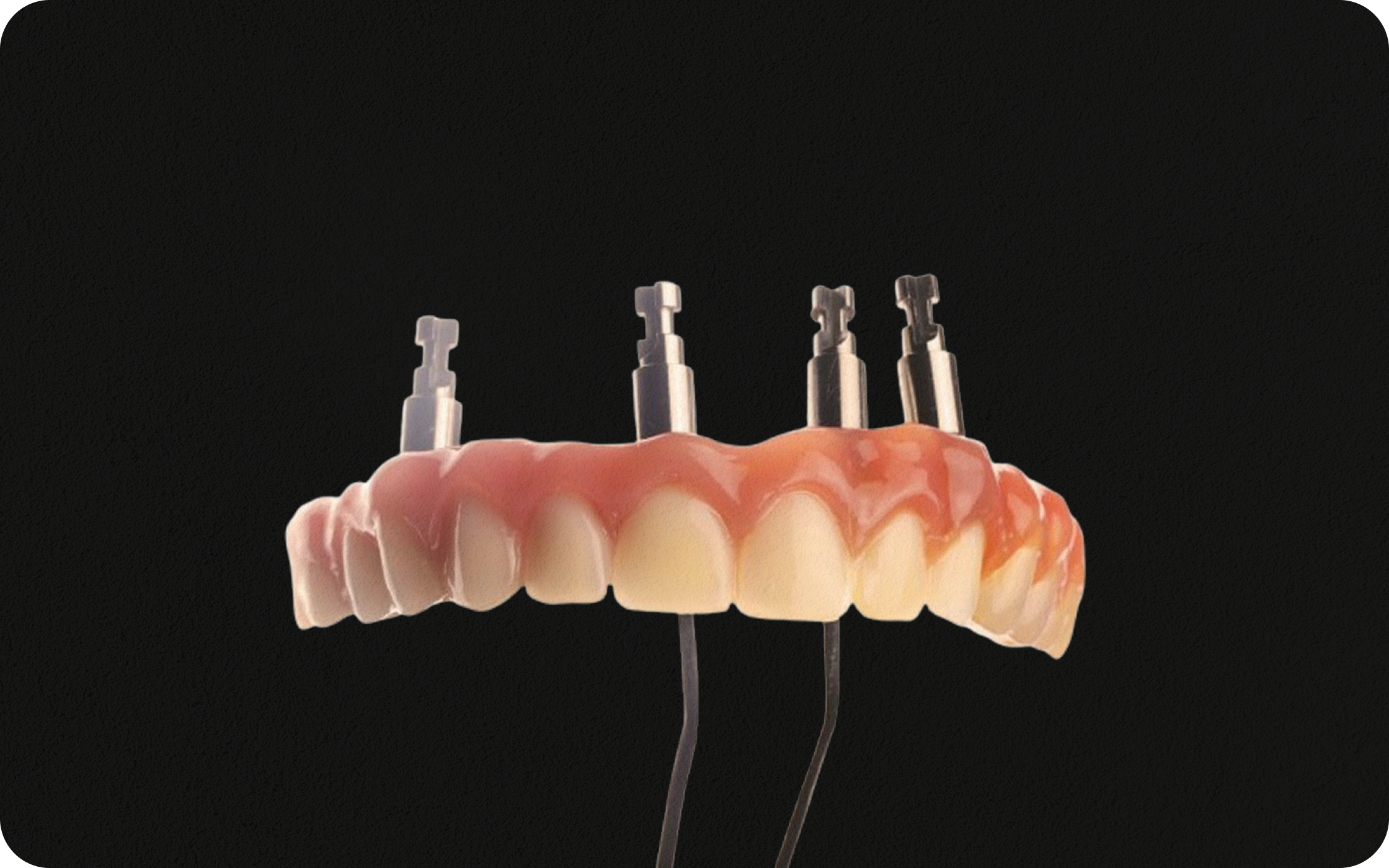 Luxur Hybrid Dentures