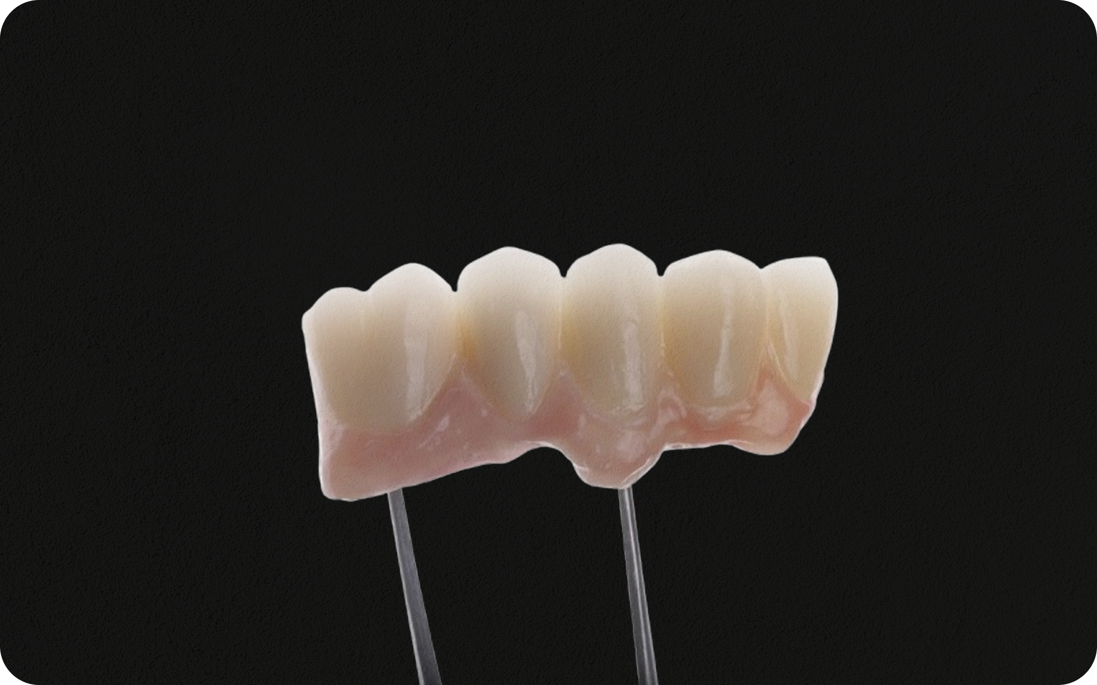 Luxur Multi-Layered Zirconia